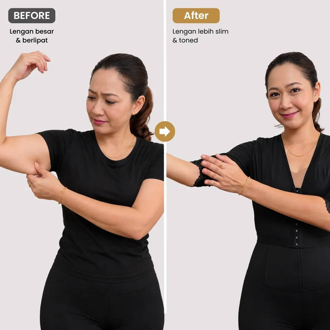 Hasil pemakaian Arm Shaper Fit